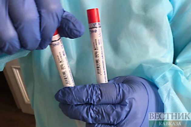 Number of COVID-19 cases in Armenia exceeds 5,900  