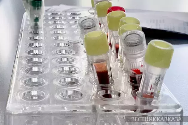 Almost 80 people seek medical attention in Turkish parliament