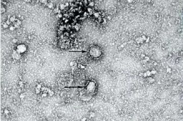 Coronavirus postpones Chinese Davos&#039;