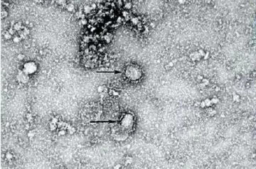 Canada invests in coronavirus research as cases continue to rise