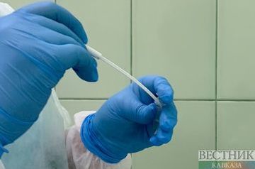 Production of Domestic PCR Tests for COVID-19 Starts in Azerbaijan