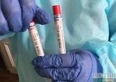 Russia starts preclinical coronavirus vaccine trials on May 11 