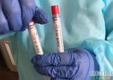 Blood plasma from coronavirus survivors transfused to first patients in Moscow