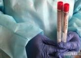 Azerbaijan confirms 38 new COVID-19 cases