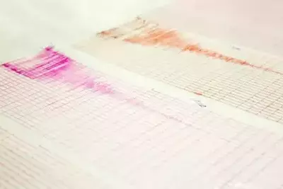 Earthquake hits Azerbaijan's Imishli district